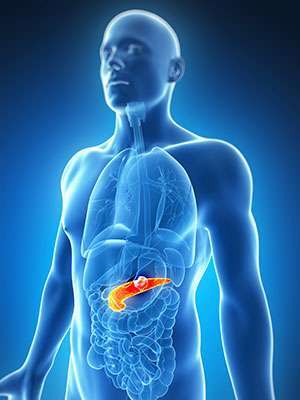 A pancreatic tumor is located in the pancreas, deep in the abdomen, behind the stomach.