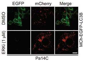 Colorful pancreatic cancer cells indicate changes in autophagy due to KRAS pathway inhibition