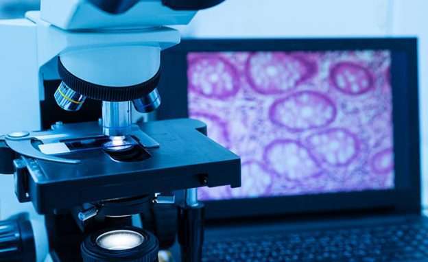 Microscope in pancreatic cancer research lab analyzes tissue sample